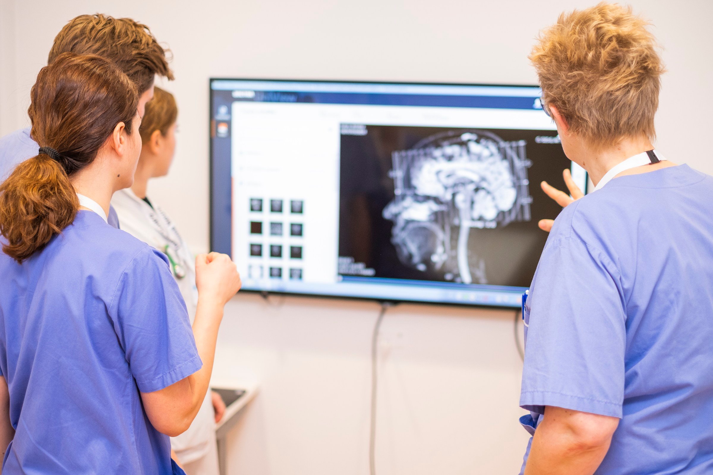 medical staff looking at brain x-ray on screen
