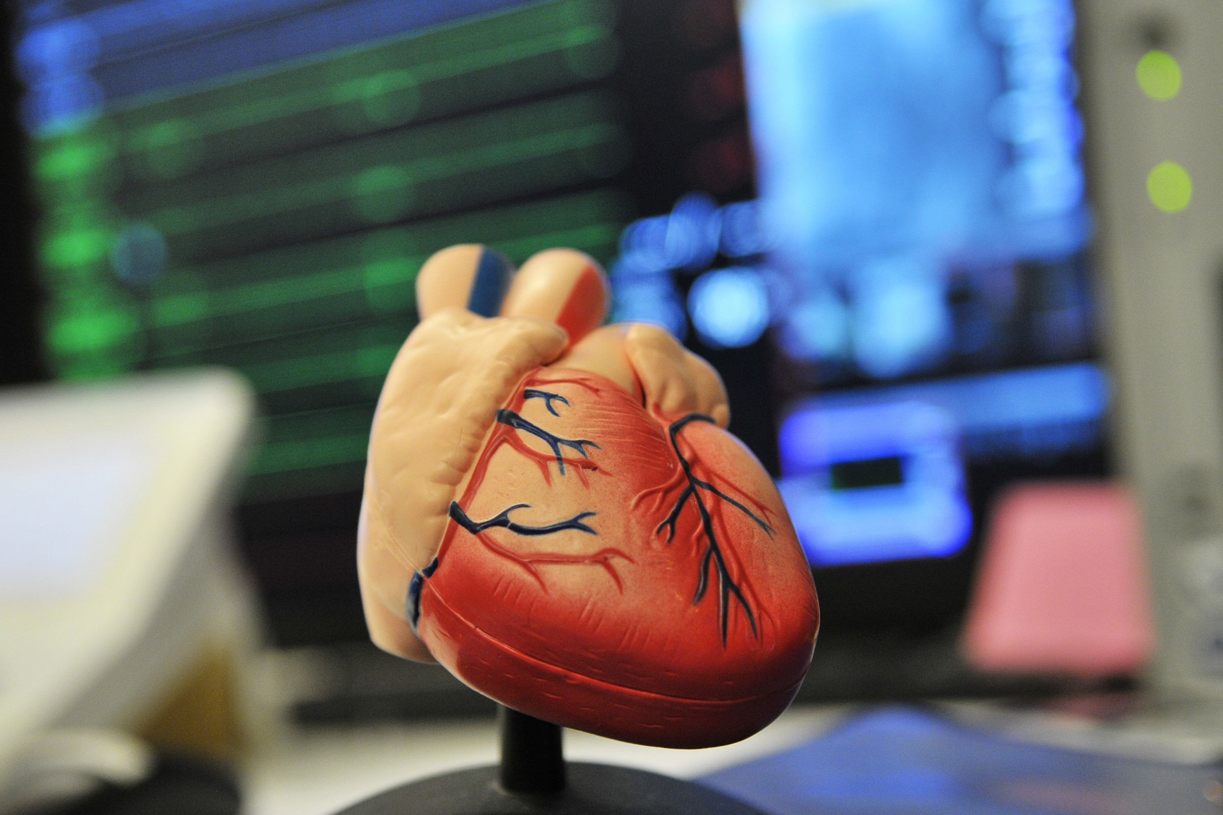 heart model in front of screens