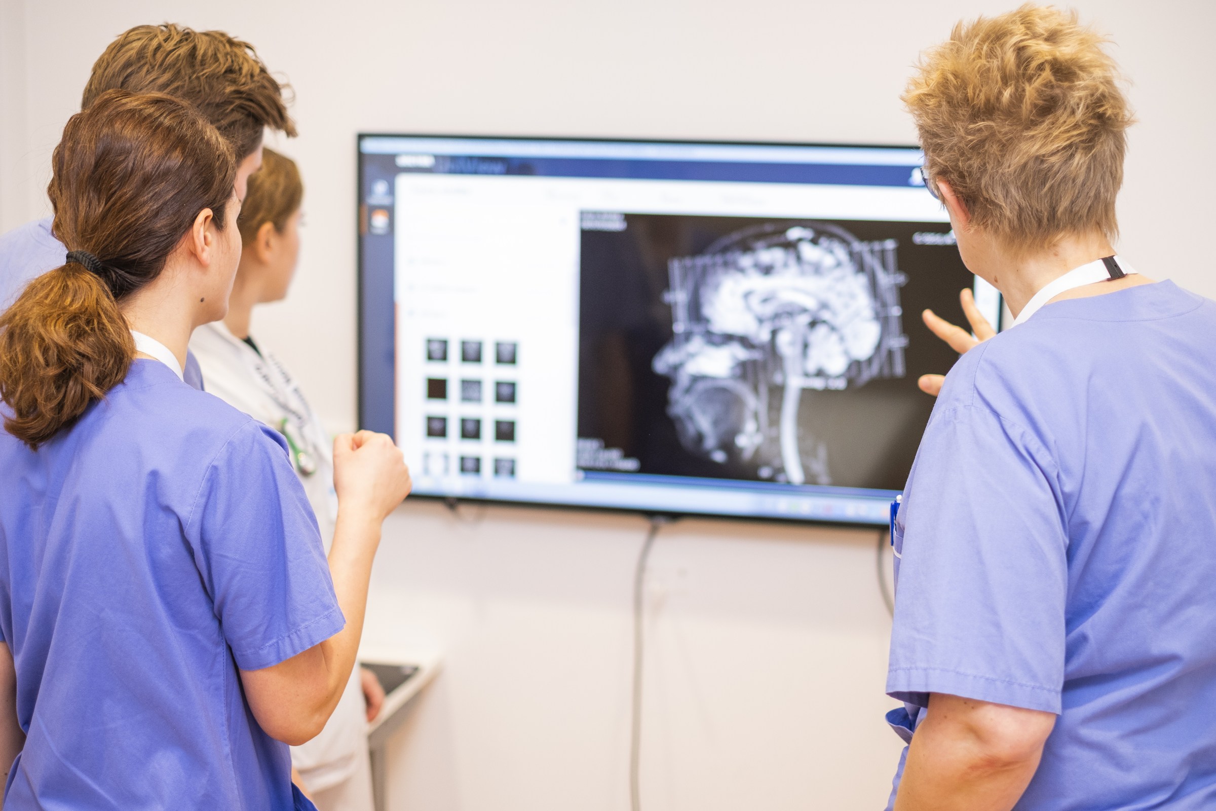medical staff looking at brain x-ray on screen